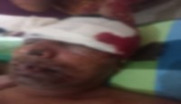 চাঁদা না দেওয়ায় মান্দায় হামলা, হাতুড়িপেট...